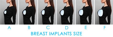 隆胸|Breast Augmentation: What it is, Types, Surgery